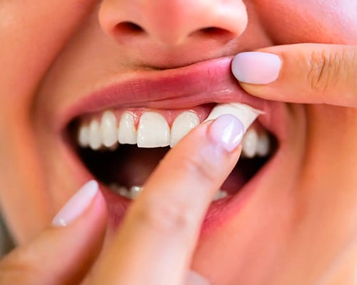 pouche dans la bouche.jpg