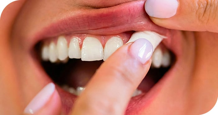 l'utilisation d'une nicotine pouche